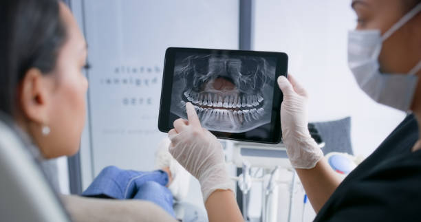 Licensed Tooth Extraction service in Parsippany, NJ - Smile Center Dentistry